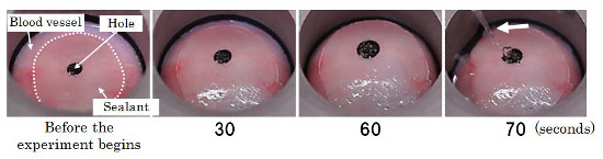 "Figure 2: Observation of sealant applied over a hole that was created in a porcine blood vessel. After the application, saline was used to make the tissue swell. In this experiment, the commercially-available sealant applied burst only in a few seconds; in contrast, the sealant we developed maintained its integrity for 70 seconds (the arrow is pointing at saline vigorously coming out of the burst sealant). These results indicate that the new sealant was significantly stronger than the commercially-available sealant in terms of interfacial strength between the sealant and blood vessel." Image