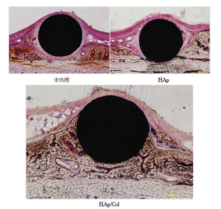 "Figure : Photographs of tissue preparation during 4 weeks after surgery. In the upper 2 photos, soft tissue (dyed pink) exists between titanium material (black) and bone tissue (dyed brown); however, with the HAp/Col in the lower photos, direct bonding has occurred between the material and the bone." Image