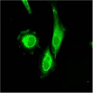 "Figure 2: Fluorescent imaging of HeLa cell" Image