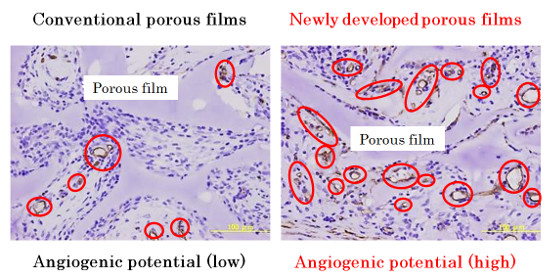 "Rat tissues 7 days after subcutaneous implantation of porous films. Red circles indicate newly formed blood vessels. There were few newly formed blood vessels in the tissue treated with conventional porous films (left). In contrast, there were many blood vessels formed in the tissue treated with the newly developed porous films (right)." Image