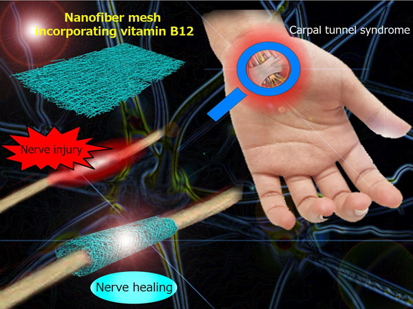 "Figure 1. Conceptual diagram showing a nanofiber mesh incorporating vitamin B12 and its application to treat a peripheral nerve injury." Image