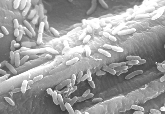 "Electron microscope image of bacteria generating electricity on carbon electrode surfaces" Image