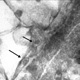 Iron sulfide nanoparticles accumulated inside and outside the cellular membrane in an iron-corroding bacterium