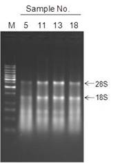 図１　精製したRNA（代表例）