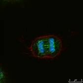 細胞の蛍光染色：青く見えている部分がDAPIで染色された染色体