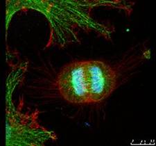 共焦点レーザー走査蛍光顕微鏡で観察した細胞（上から見た図）