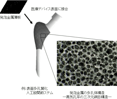 「プレス試料中の図 : 発泡金属による医療デバイスの表面処理例および発泡金属構造拡大図」の画像