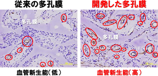 「プレスリリースの図1 : 多孔膜をラット皮下へ埋入して7日後の組織像。赤丸は、新生血管を示す。従来の多孔膜 (左) は新たに形成された血管の量が少ないのに対し、開発した多孔膜 (右) には、多くの血管が形成されている。」の画像