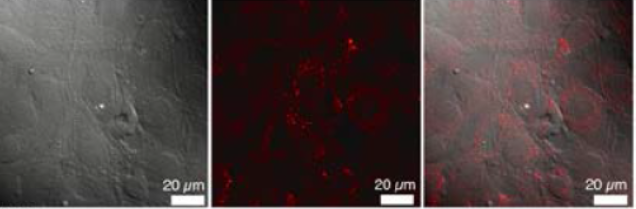 「プレスリリースの図1 : 　NIH3T3細胞の微分干渉顕微鏡像(左)、共焦点蛍光顕微鏡像(右)、両顕微鏡像を重ね合わせた像(中央)」の画像