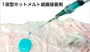 1液型ホットメルト組織接着剤のイメージ