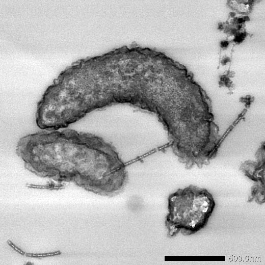 電気細菌の顕微鏡写真